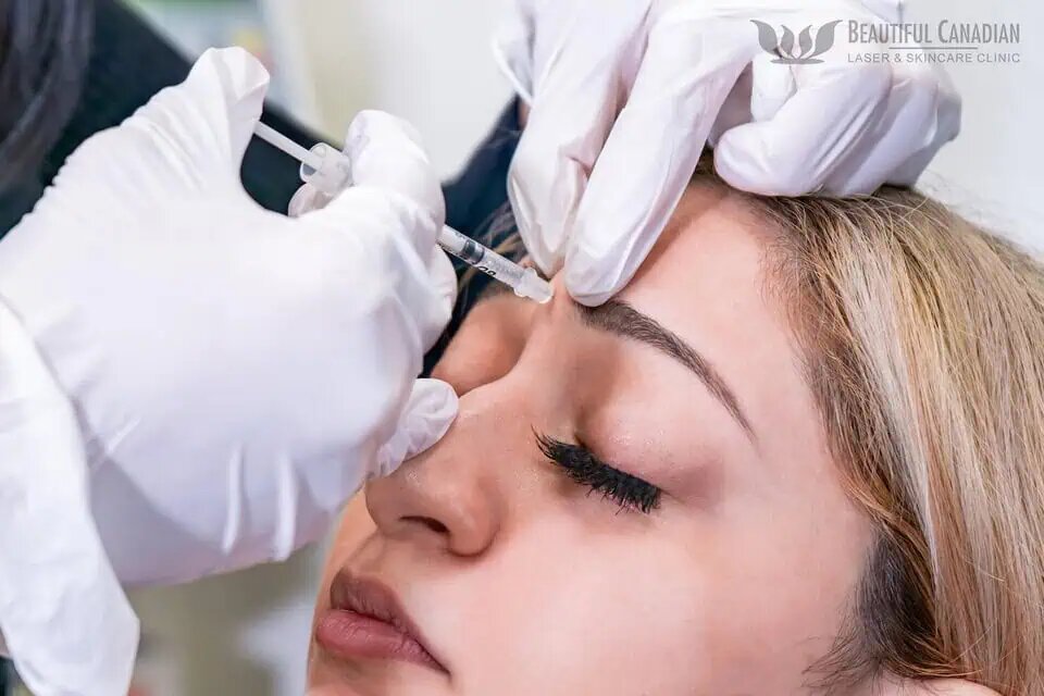 Why Botox Is a Popular Non-Surgical Option in Vancouver