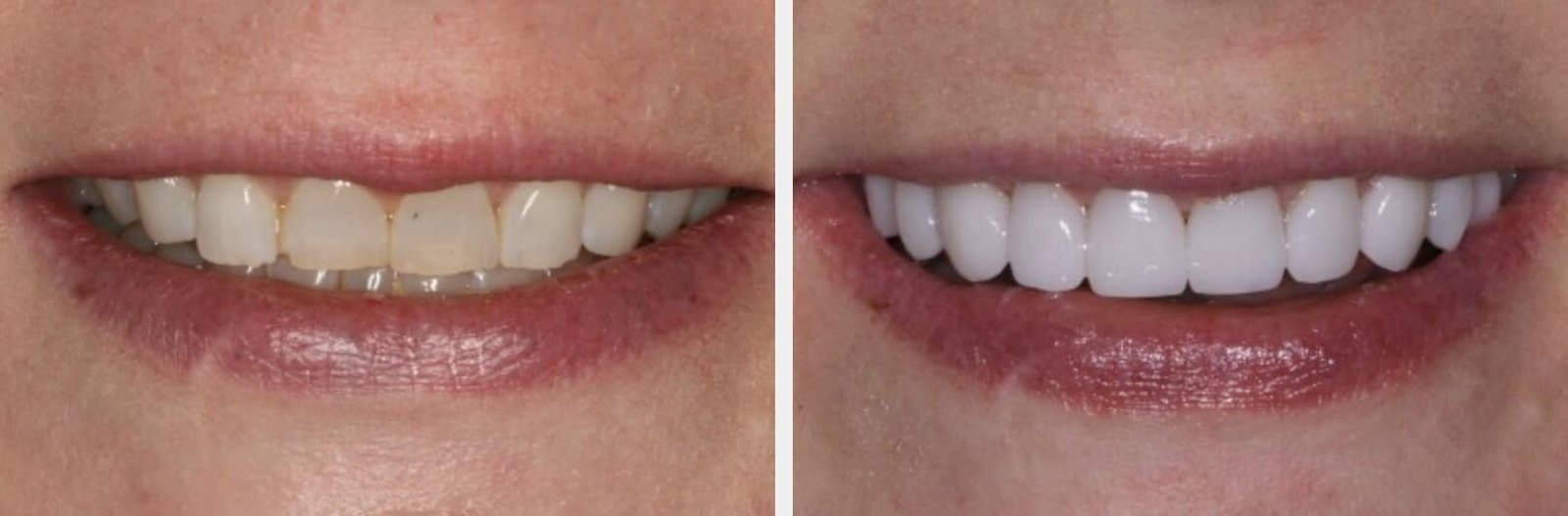 What to Look for When Choosing a Dentist in Sugar Land